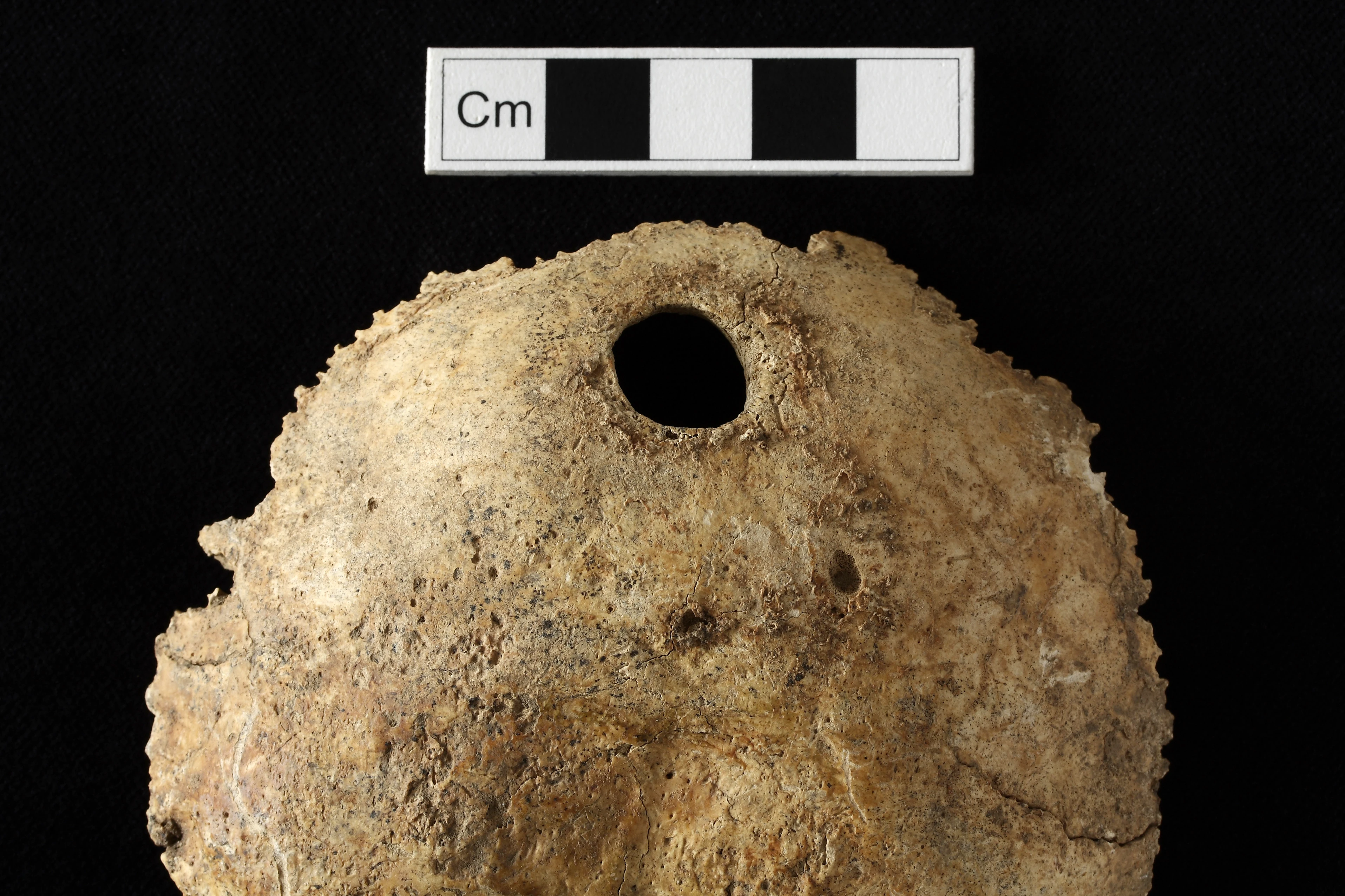 A skull showing signs of trepanation